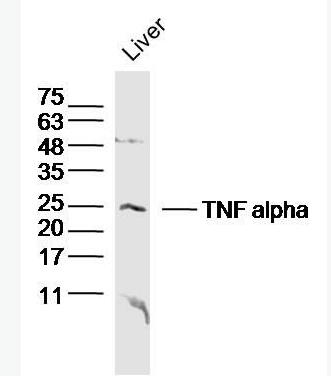 Anti-TNF alpha antibody-腫瘤壞死因子-α/TNFα抗體,TNF alpha