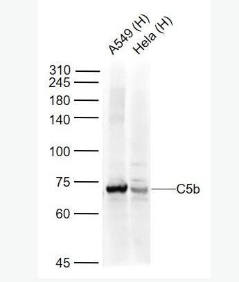 Anti-C5b-9 antibody-末端補(bǔ)體復(fù)合物抗體,C5b-9