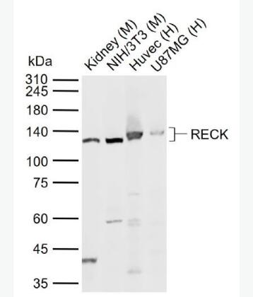 Anti-RECK antibody-金属蛋白酶抑制因子RECK抗体,RECK