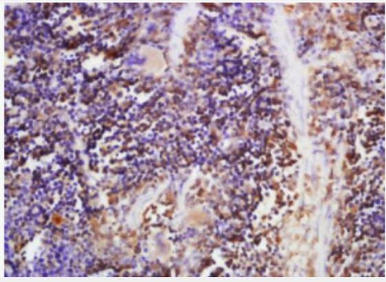 Anti-Nucleobindin 2 antibody-新的饱食分子蛋白抗体,Nucleobindin 2