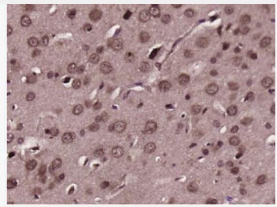 Anti-PLCG 2 antibody-磷酯酶Cγ2抗體,PLCG 2