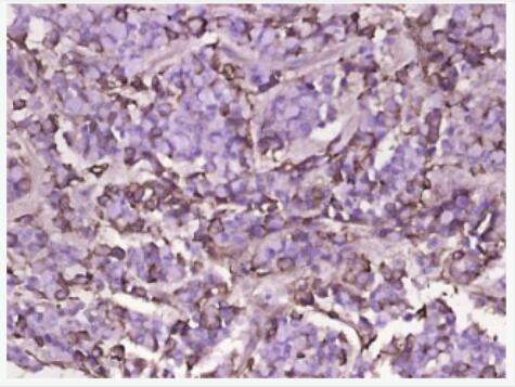 Anti-D-DIMER antibody-交联纤维蛋白二聚体抗体,D-DIMER