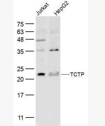 Anti-TCTP antibody-翻译控制肿瘤蛋白抗体,TCTP