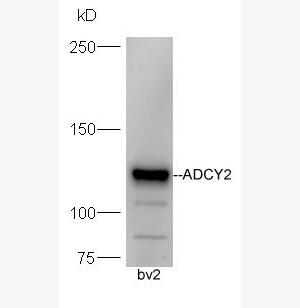 Anti-ADCY2 antibody-腺苷酸環(huán)化酶2抗體,ADCY2