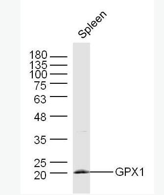 Anti-GPX1 antibody-谷胱甘肽过氧化酶1,GPX1