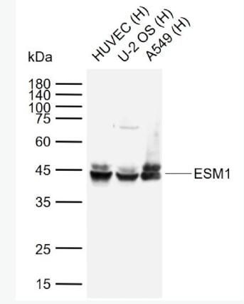 Anti-ESM1 antibody-內皮細胞特異性分子1抗體,ESM1