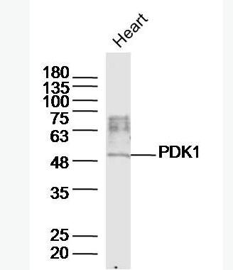 Anti-PDK1/Mitochondrial Pyruvate dehydrogenase kinase 1  antibody-丙酮酸脫氫酶激酶1抗體,PDK1/Mitochondrial Pyruvate dehydrogenase kinase 1