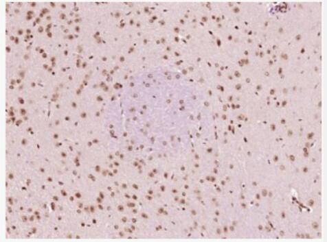 Anti-HSF1  antibody-热休克因子1抗体,HSF1