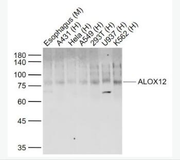 Anti-ALOX12 antibody-12脂氧合酶抗体,ALOX12
