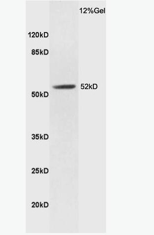 Anti-LXR alpha antibody-肝脏X受体抗体,LXR alpha