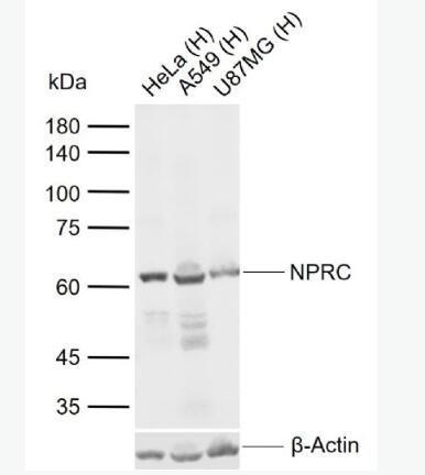 Anti-NPRC antibody-利钠肽受体C抗体,NPRC