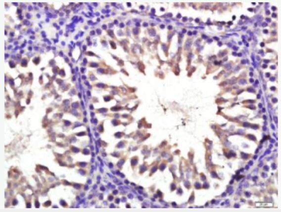 Anti-CYP11B1 antibody-细胞色素P450 11B1抗体,CYP11B1