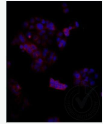 Anti-LRP2 antibody-糖蛋白gp330抗体,LRP2