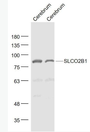 Anti-SLCO2B1 antibody-可溶性载质转运蛋白2B1抗体,SLCO2B1