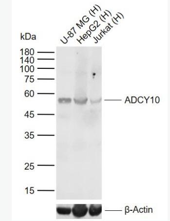 Anti-ADCY10 antibody-腺苷酸环化酶10抗体,ADCY10