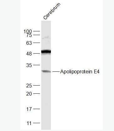 Anti-Apolipoprotein E4 antibody-载脂蛋白E4抗体,Apolipoprotein E4