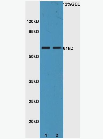 Anti-IL22R antibody-白介素22受體抗體,IL22R