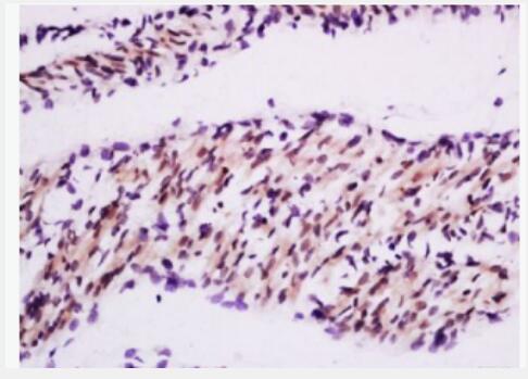 Anti-MuRF1 antibody-肌肉细胞特异性泛素蛋白连接酶1抗体,MuRF1