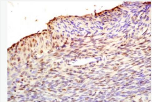 Anti-Fbx32 antibody-泛素蛋白连接酶抗体,Fbx32