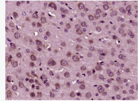 Anti-CXCL9 antibody-γ干擾素誘導(dǎo)單核細胞因子抗體,CXCL9