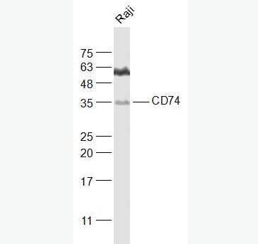 Anti-CD74 antibody-CD74抗體,CD74