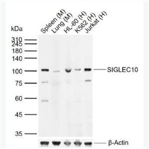 Anti-SIGLEC10 antibody-肿瘤坏死因子配体超家族成员14抗体