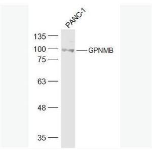 Anti-GPNMB antibody-GPNMB抗体