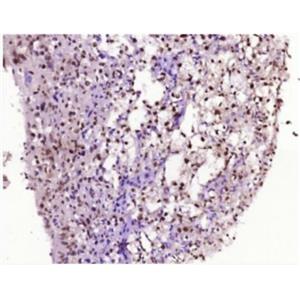 Anti-TNFAIP3 antibody-肿瘤坏死因子α诱导蛋白3抗体