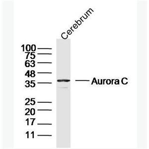 Anti-Aurora C antibody-有丝分裂激酶B抗体
