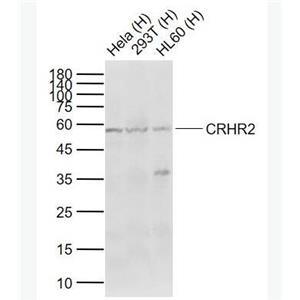 Anti-CRHR2 antibody-促肾上腺皮质释放激素受体2抗体
