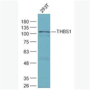 Anti-THBS1 antibody-体超家族成员14抗体