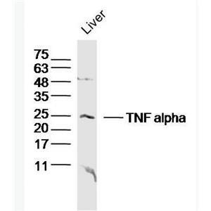 Anti-TNF alpha antibody-肿瘤坏死因子-α/TNFα抗体