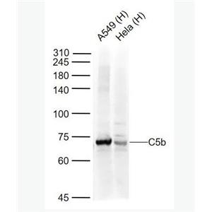 Anti-C5b-9 antibody-末端补体复合物抗体