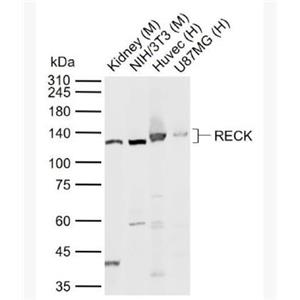 Anti-RECK antibody-金属蛋白酶抑制因子RECK抗体,RECK