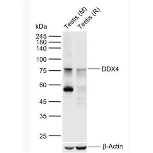 Anti-DDX4 antibody-DDX4抗体