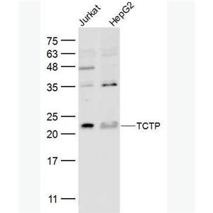 Anti-TCTP antibody-翻译控制肿瘤蛋白抗体,TCTP