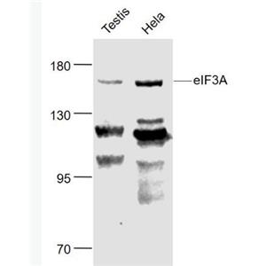Anti-eIF3A antibody-真核翻译起始因子3A抗体,eIF3A