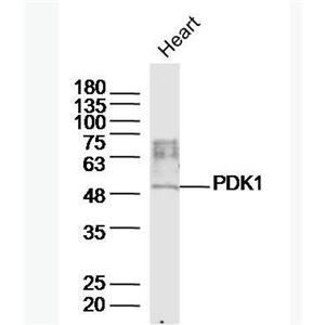 Anti-PDK1/Mitochondrial Pyruvate dehydrogenase kinase 1  antibody-丙酮酸脱氢酶激酶1抗体