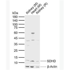 Anti-SDHD antibody-线粒体琥珀酸脱氢酶D抗体
