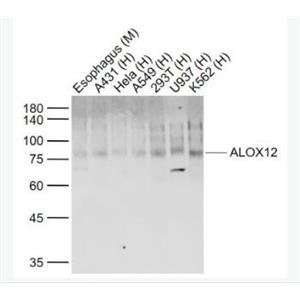 Anti-ALOX12 antibody-12脂氧合酶抗体,ALOX12