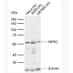 Anti-NPRC antibody-利钠肽受体C抗体