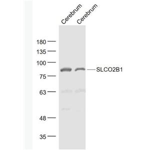 Anti-SLCO2B1 antibody-可溶性载质转运蛋白2B1抗体