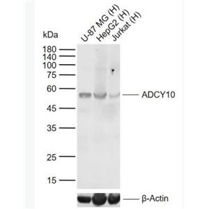 Anti-ADCY10 antibody-腺苷酸环化酶10抗体,ADCY10