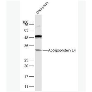 Anti-Apolipoprotein E4 antibody-载脂蛋白E4抗体