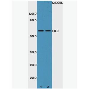 Anti-IL22R antibody-白介素22受体抗体