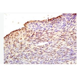 Anti-Fbx32 antibody-泛素蛋白连接酶抗体,Fbx32