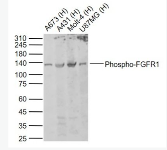 Anti-Phospho-FGFR1 (Tyr154) antibody-磷酸化碱性成纤维细胞生长因子受体1（CD331）抗体,Phospho-FGFR1 (Tyr154)