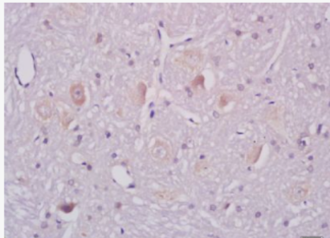 Anti-ganglioside GM1  antibody-神经节苷酯抗体,ganglioside GM1