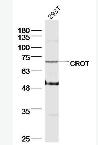 Anti-CROT antibody-肉碱氧位甲基转移酶抗体,CROT