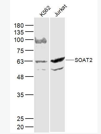 Anti-SOAT2 antibody-胆固醇酰基转移酶2抗体,SOAT2